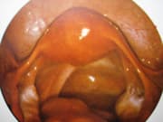 Coelioscopie: pelvis normal